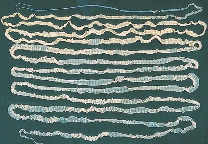 Дифиллоботриоз