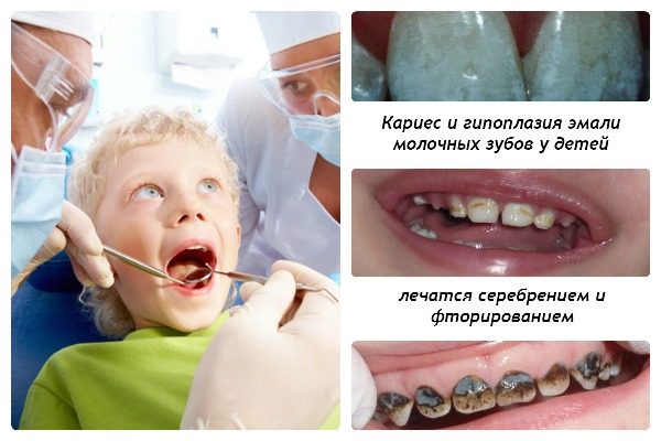 фторирование серебрение