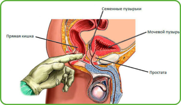 Преимущества массажа предстательной железы