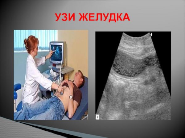 В каких случаях назначают УЗИ желудка?
