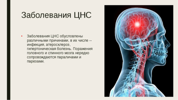 Заболевания нервной системы
