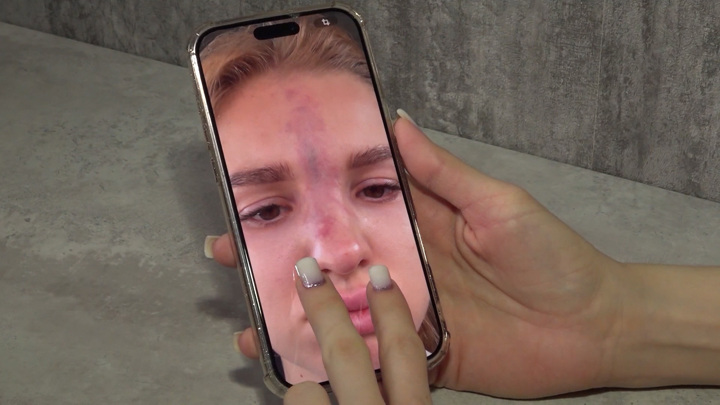 Косметологов обяжут изучать протокол действий при реанимации