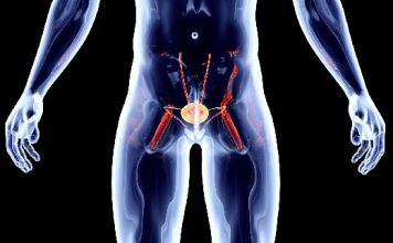 ASCO: воздействие микропластика может быть фактором риска рака простаты