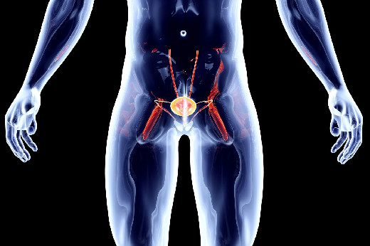 ASCO: воздействие микропластика может быть фактором риска рака простаты