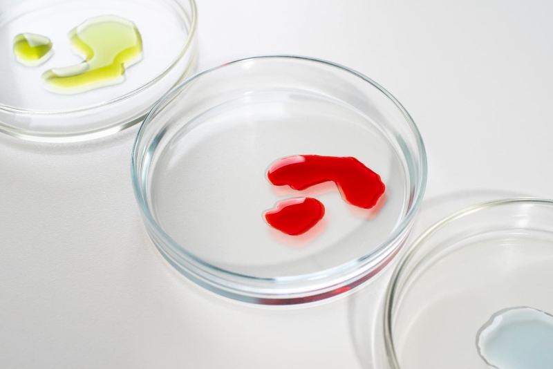 Кеторолак демонстрирует превосходство в обезболивании и безопасности по сравнению с опиоидами при вазо-окклюзивном кризе.